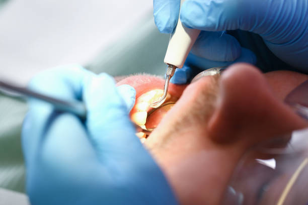 Best Urgent Care for Lost Fillings or Crowns in Wahese, NC