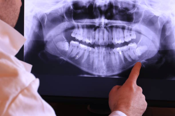 Best Emergency Gum Treatment in Wahese, NC