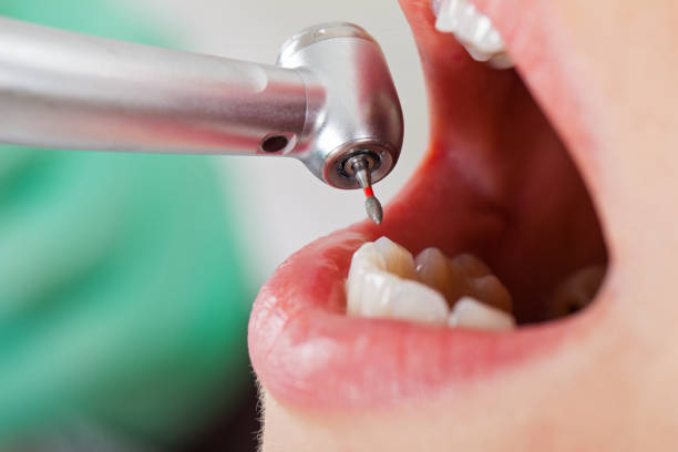 Best Emergency Tooth Extraction in Wahese, NC
